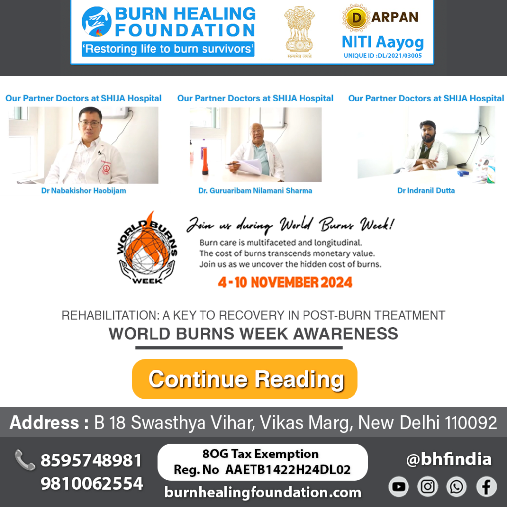 Rehabilitation: A Key to Recovery in Post-Burn Treatment