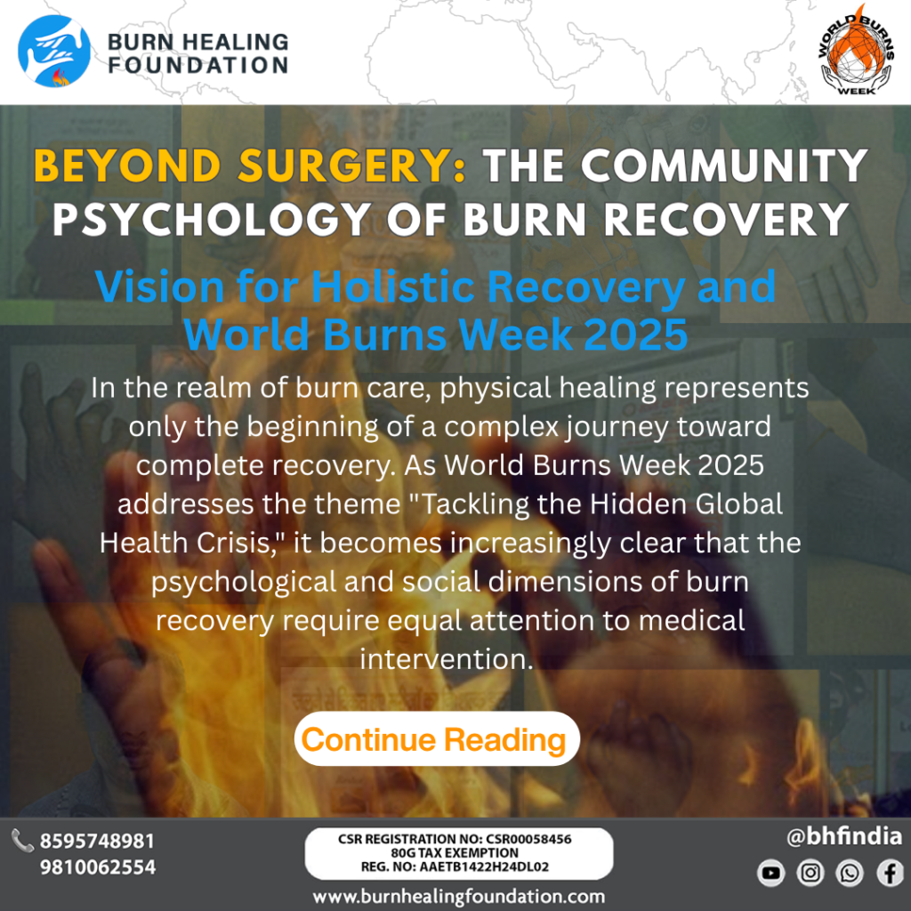 Beyond Surgery: The Community Psychology of Burn Recovery